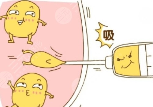 腹部抽脂术后需要修复几天才能恢复？