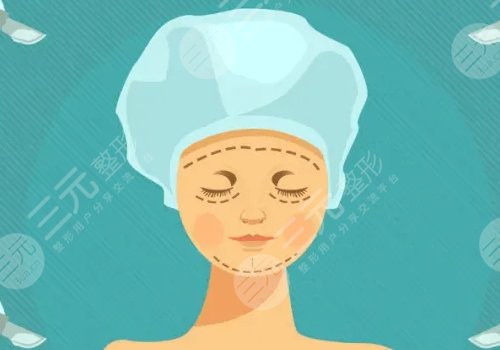 自体脂肪填充下眼睑凹陷可以维持多久？