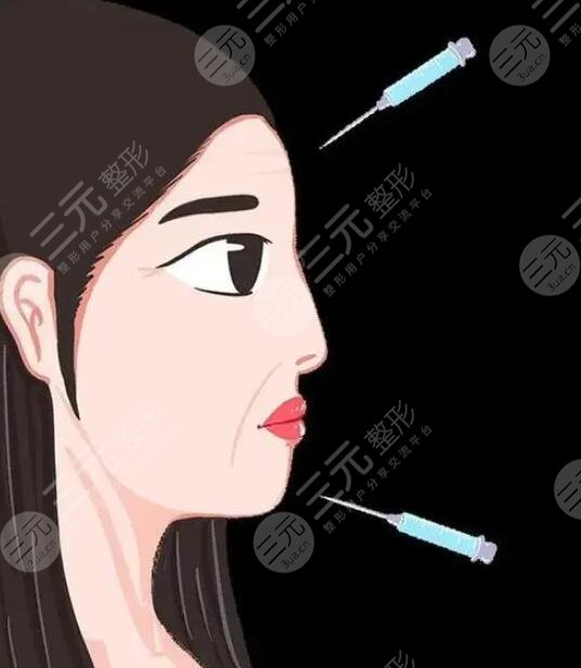 玻尿酸注射隆鼻效果怎样？大量网友选择它的优势是什么？为什么人气高？