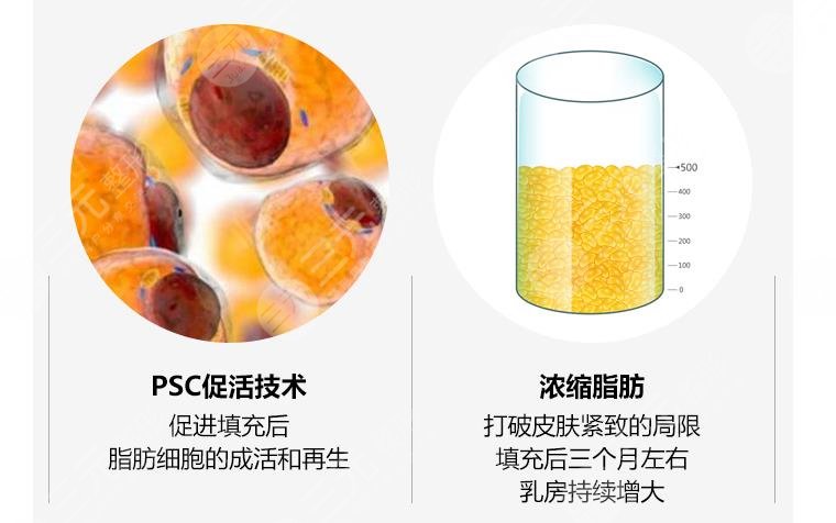 隆胸材料有哪些?哪种手感好??