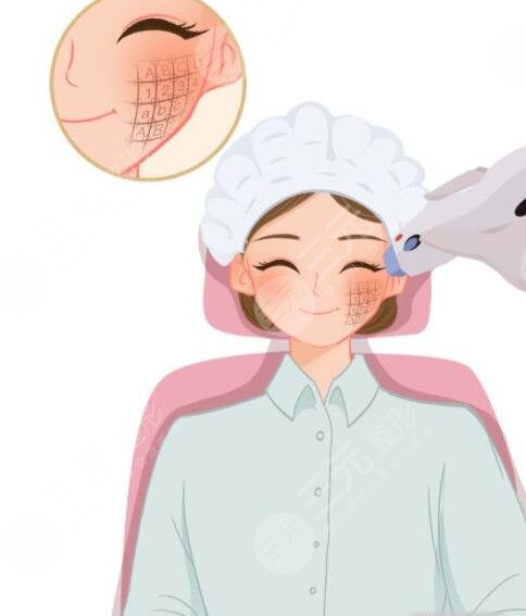热玛吉紧肤效果怎么样?
