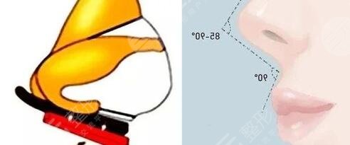 肋软骨隆鼻的优势是什么？为什么隆鼻医生会主推？必有它的过人之处！