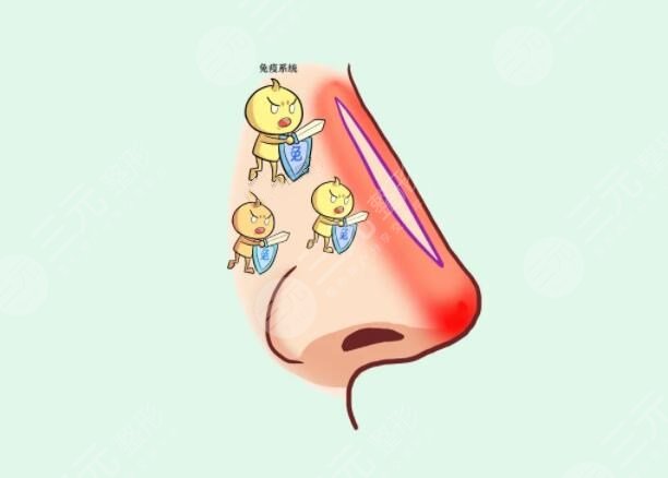 肋软骨隆鼻的优势是什么?