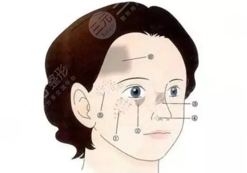 激光祛斑多久能恢复正常皮肤？
