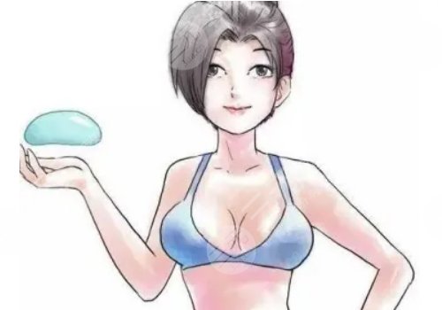 假体隆胸术有哪些特点？