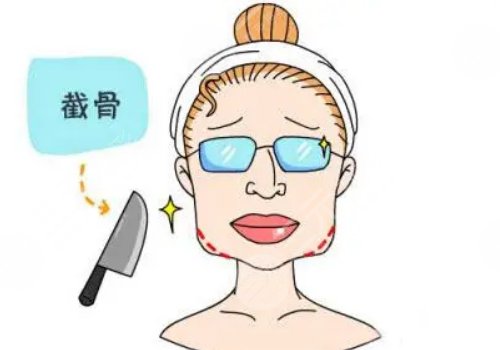 下颌角宽大怎么改善？