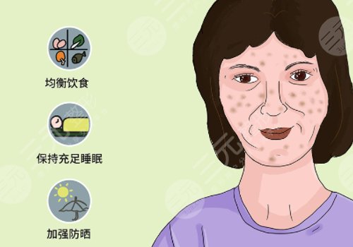 怎样去除面部黄褐斑有效?