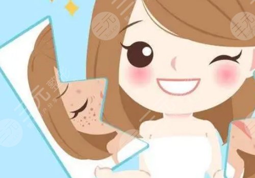 激光去斑点要多少钱