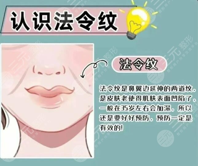 激光去法令纹