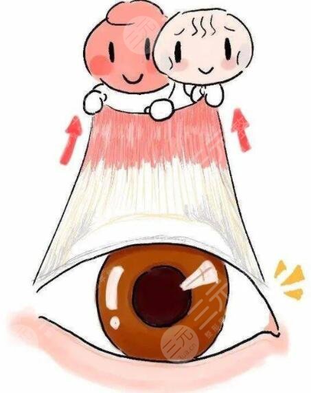 上眼睑下垂恢复锻炼法有用吗?