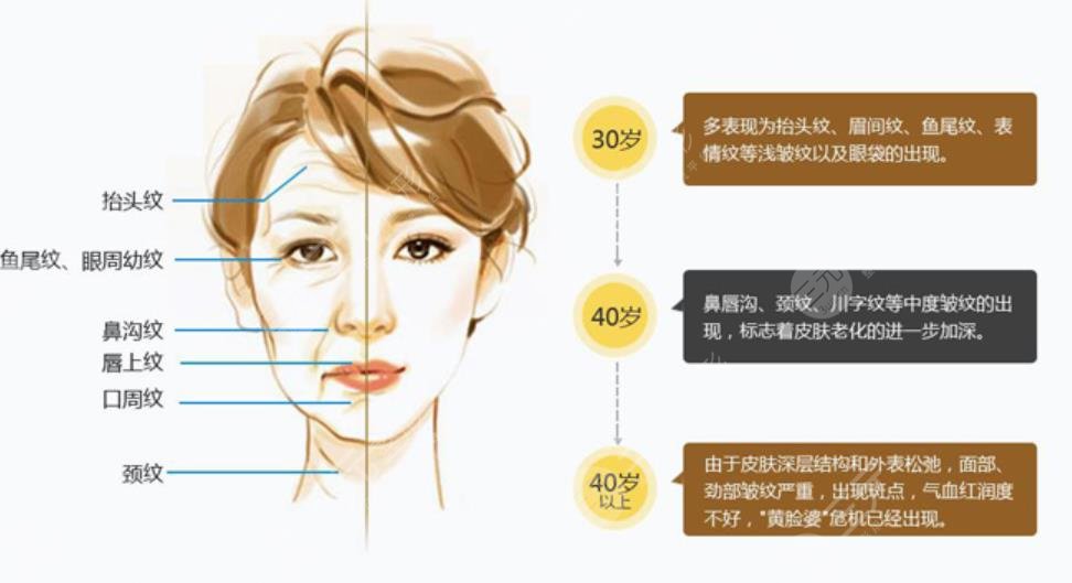 除皱