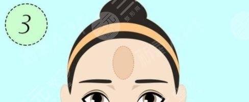 额头填充