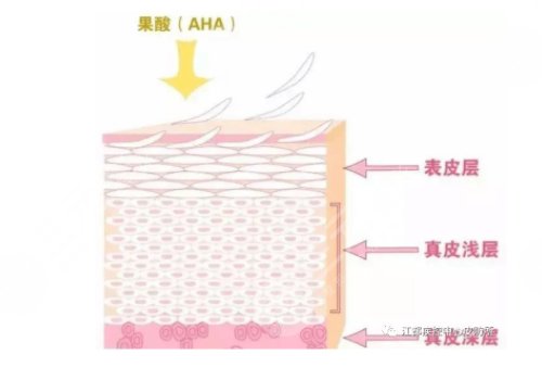 果酸换肤的功有什么?
