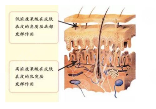 果酸换肤的功有什么?