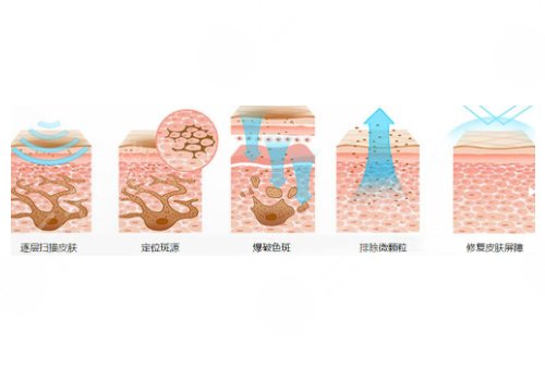 激光祛斑多久能恢复正常皮肤啊?