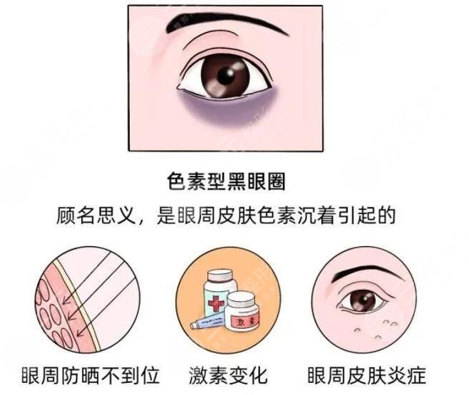 消除黑眼圈之后需要注意什么?