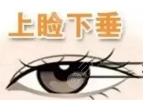 上睑下垂矫正手术有风险吗?