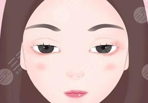 上睑下垂矫正手术有风险吗?