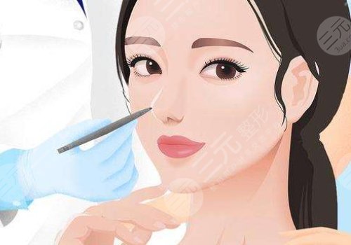 瑞蓝玻尿酸分几种型号？