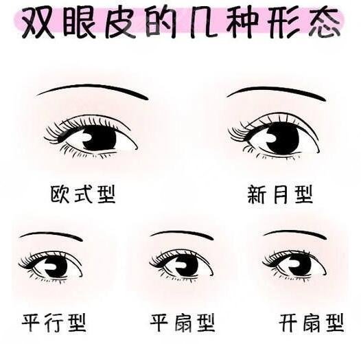 做哪种双眼皮好?
