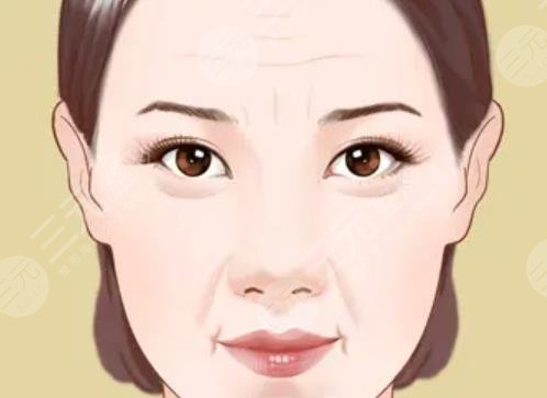 皮肤松弛