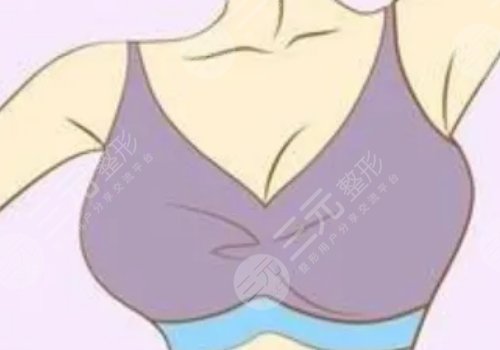 丰胸材料哪种好?
