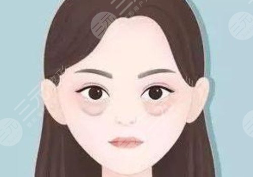祛黑眼圈和眼袋的方法是什么?