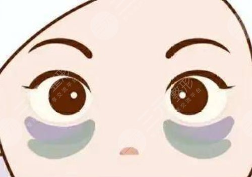 祛黑眼圈的家庭小妙招分享