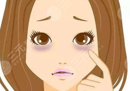 祛黑眼圈的家庭小妙招分享