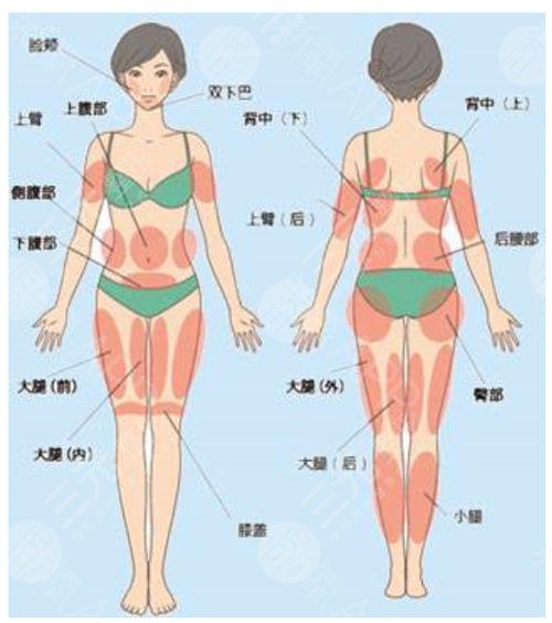 抽脂的危害和副作用有哪些?