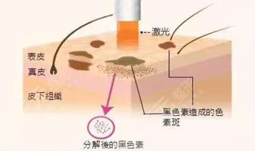 现在的医美技术也发展的很不错