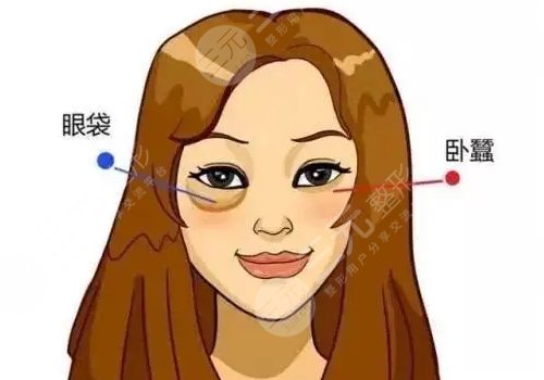不手术去眼袋的方法有哪些?