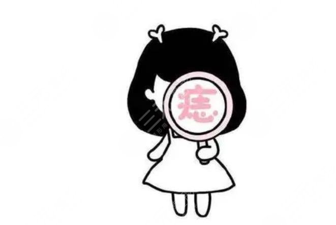 色素痣是怎么形成的