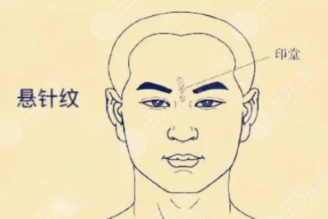 悬针纹