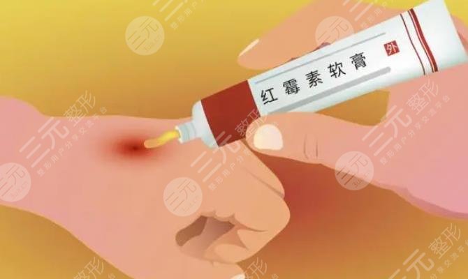 红霉素软膏治痘痘