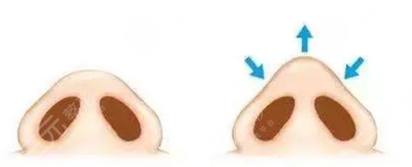 鼻头