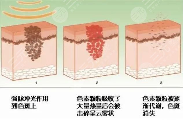 彩光嫩肤