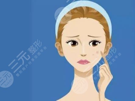 青春痘疤痕