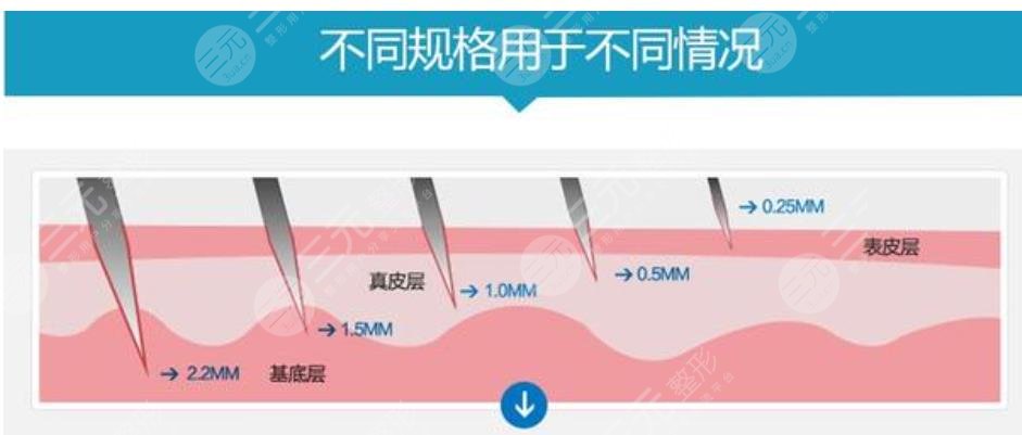微针