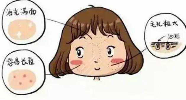 油性皮肤
