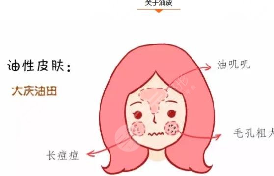 油性皮肤