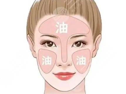 油性皮肤