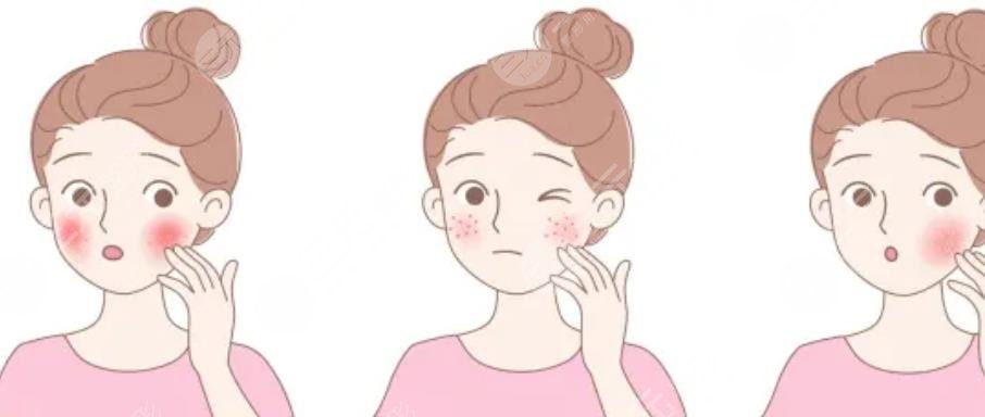 嫩肤