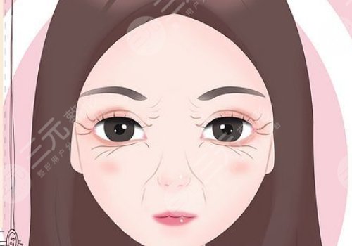 如何减少鱼尾纹的生成？