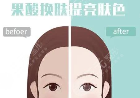 果酸换肤