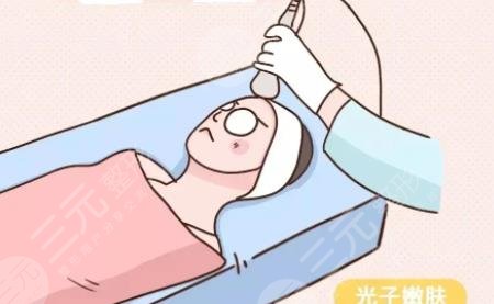 光子嫩肤