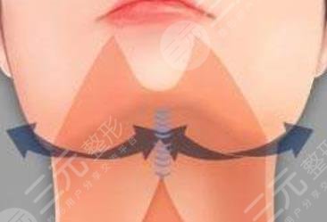 双下巴