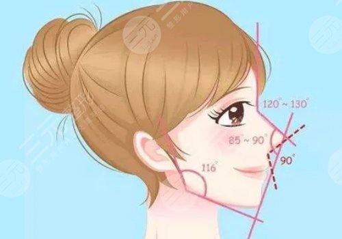 膨体隆鼻恢复时间需要多久？