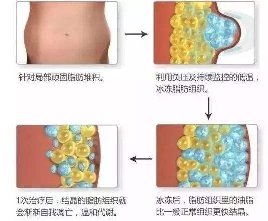 常年吃减肥药的危害有多大你知道吗！科普带你了解，塑身美体不盲目~