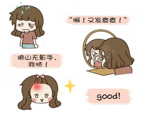 中医祛痘调理方法有哪些可靠?